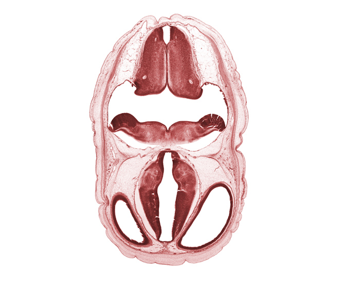 alar plate(s), artifact space(s), basal plate, dorsal thalamus, dural band for tentorium cerebelli, floor plate, hypothalamic sulcus, hypothalamus, lateral ventricle, obex, rhombencoel (fourth ventricle), roof plate, subarachnoid space, sulcus dorsalis, sulcus medius, third ventricle, ventral thalamus