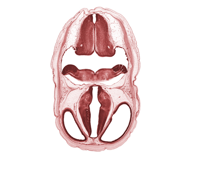 alar plate(s), basal plate, basilar artery, decussation, dorsal thalamus, edge of endolymphatic duct, exoccipital, floor plate, floor plate of diencephalon, hypothalamic sulcus, hypothalamus, lateral ventricle, median sulcus, roof plate of diencephalon, roof plate of myelencephalon, subarachnoid space, sulcus dorsalis, third ventricle, venous plexus(es), ventral thalamus