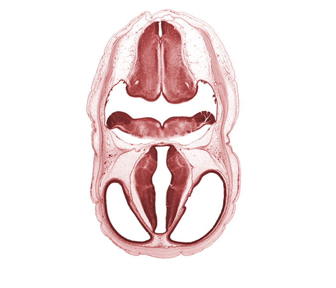 alar plate(s), artifact space(s), basal plate, basilar artery, caudal part of obex, decussation in floor plate of myelencephalon, exoccipital, fiber tract, head mesenchyme, hypothalamic sulcus, hypothalamus, lateral ventricle, median sulcus, posterior communicating artery, roof plate of myelencephalon, subarachnoid space, surface ectoderm, third ventricle, venous plexus(es)