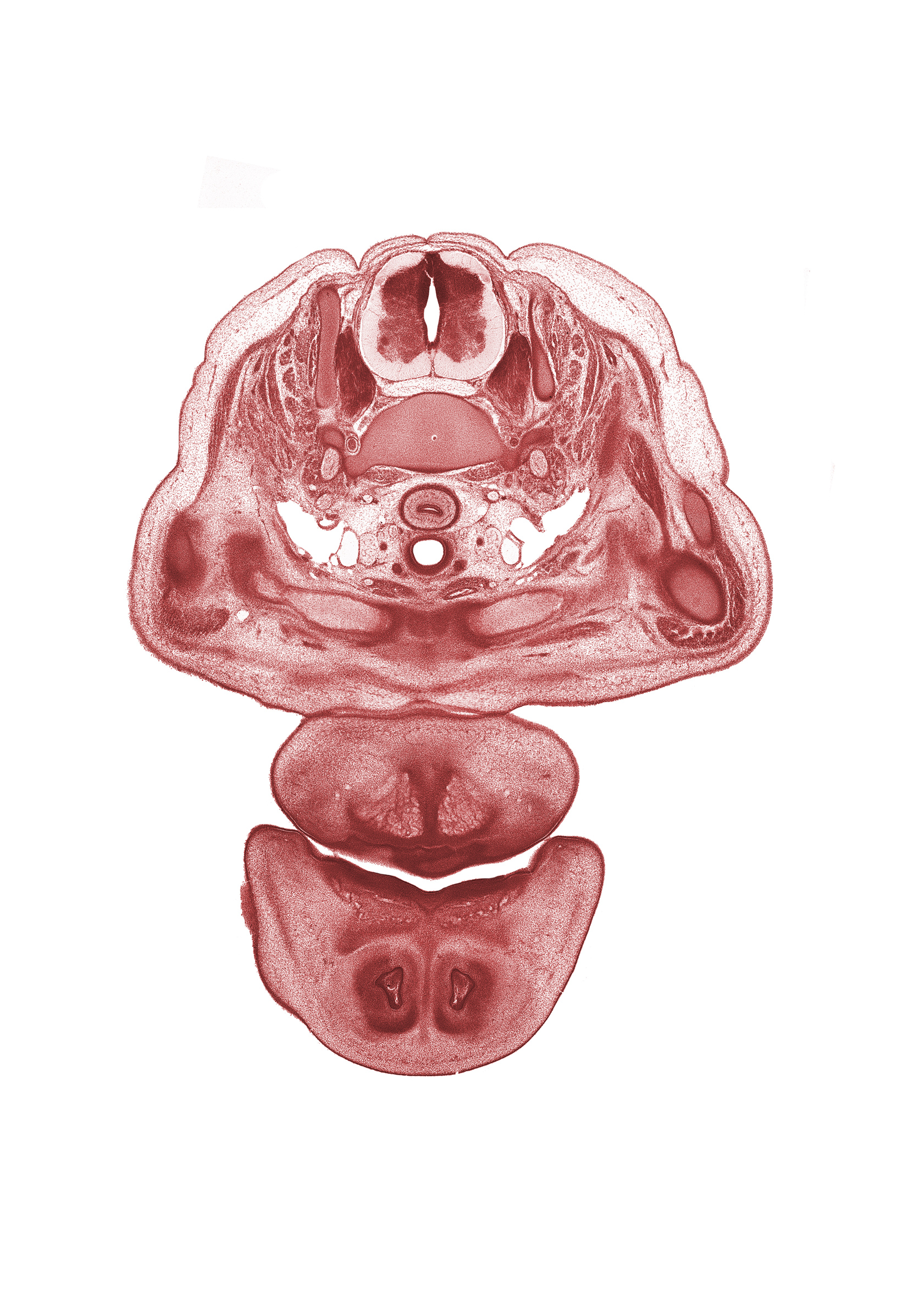 C-7 spinal ganglion, C-7 spinal nerve, alar plate(s), basal plate, clavicle, common carotid artery, internal jugular vein, jugular lymph sac, nasal septal cartilage, neural arch, oral cavity, oral fissure, osteogenic layer, primary palate, sternoclavicular joint, sulcus limitans, sympathetic trunk, trachea, vertebral artery