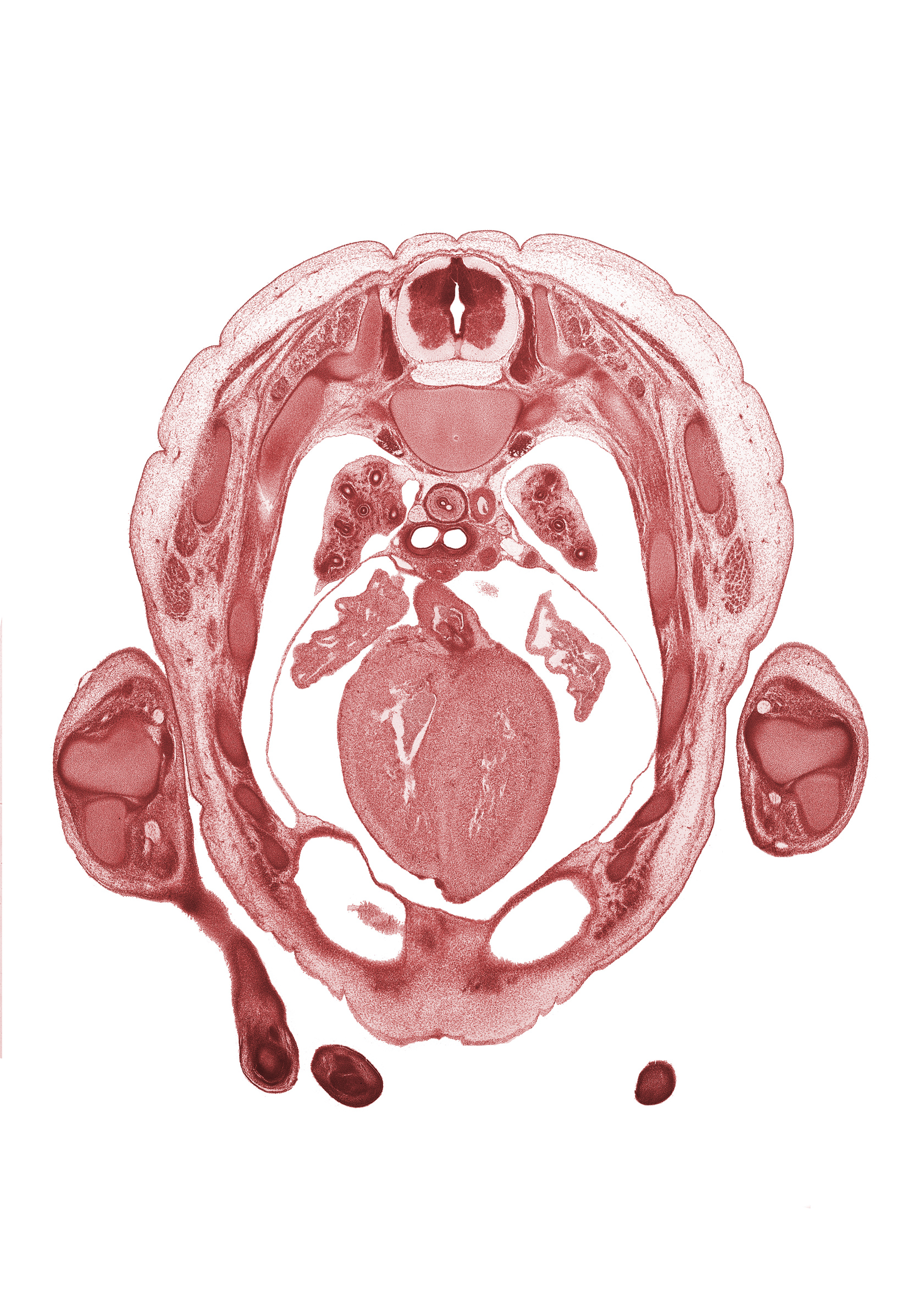 T-3 intercostal nerve, T-3 spinal ganglion, aortic semilunar valve, auricle of left atrium, auricle of right atrium, caudal edge of hand, central tendon of diaphragm, interventricular sulcus, lateral epicondyle of humerus, left primary bronchus, left ventricle, muscular part of interventricular septum, peritoneal cavity, pleural cavity, rib 4, right primary bronchus, right ventricle, scapula, transverse pericardial sinus, ulna, upper lobe of left lung, upper lobe of right lung