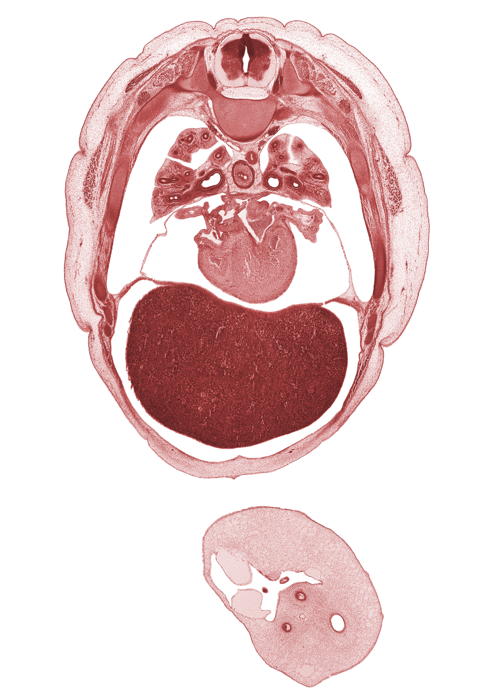 T-5 intercostal nerve, T-5 spinal ganglion, T-5 spinal nerve, horizontal fissure, left ventricle, lower secondary bronchus, middle lobe of right lung, middle secondary bronchus, pericardial sac, primary interatrial septum (septum primum), rib 6, rib 7, right ventricle, secondary interatrial foramen (foramen secundum), secondary interatrial septum (septum secundum), sinus venosus, umbilical coelom, umbilical cord, umbilical vesicle stalk, upper lobe of right lung