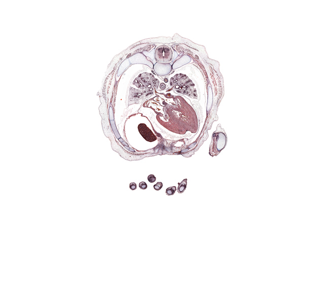 T-5 / T-6 interganglion region, aorta, azygos vein, cephalic edge of liver, coronary sinus, distal interphalangeal joint of digit 3 (middle finger), external intercostal muscle(s), iliocostalis muscle, innermost intercostal muscle(s), internal intercostal muscle(s), left upper pulmonary vein, longissimus muscle, oblique fissure, proximal phalynx of left digit 5 (little finger), rectus abdominis muscle, rib 6, rib 8, right digit 3 (middle finger), right digit 5 (little finger), right lower pulmonary vein, spinalis muscle, ulna, xiphoid