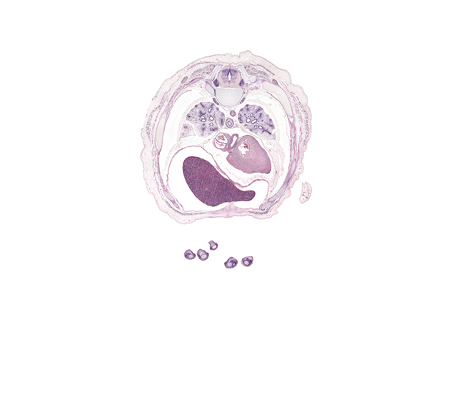 T-6 spinal ganglion, aorta, apex of heart, central tendon of diaphragm, communicating ramus, coronary sinus, elbow, esophagus muscularis, left lobe of liver, left ventricle, lingula of upper lobe of left lung, lower lobe of left lung, lower lobe of right lung, middle lobe of right lung, oblique fissure, pericardial cavity, pulmogenic mesenchyme, rib 6, rib 7, rib 8, rib 9, right lobe of liver, right ventricle, sympathetic trunk, valve of inferior vena cava