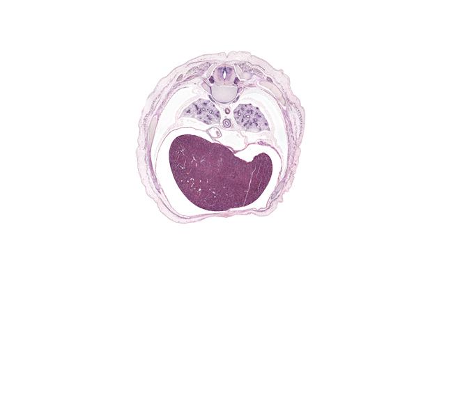 T-7 intercostal nerve, T-7 spinal ganglion, anterior rectus sheath, aorta, artifact fracture(s), central tendon of diaphragm, esophagus endoderm, external abdominal oblique muscle, falciform ligament, inferior vena cava, left lobe of liver, pericardial cavity, pericardial sac, peritoneal cavity, pulmogenic mesenchyme, pulmonary ligament, rib 8, rib 9, right lobe of liver, sympathetic trunk, trapezius muscle