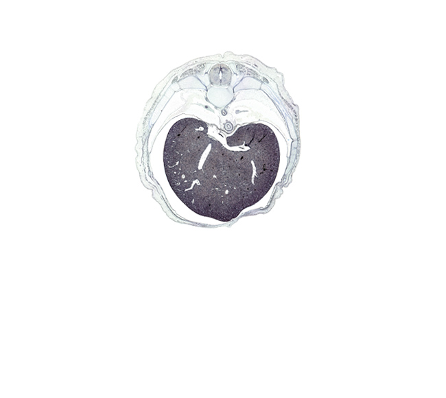 T-8 / T-9 interganglion region, caudal edge of lower lobe of left lung, efferent hepatic vein, efferent hepatic veins, iliocostalis muscle, inferior vena cava, latissimus dorsi muscle, left lobe of liver, longissimus muscle, lower lobe of right lung, multifidus muscle, pedicle of T-8 vertebra, peritoneal cavity, rectus abdominis muscle, rib 10, rib 9, right lobe of liver, spinalis muscle, transverse process of T-8 vertebra