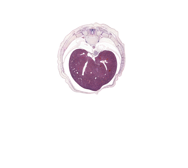 T-8 / T-9 interganglion region, anterior rectus sheath, caudal edge of lower lobe of right lung, costotransverse joint, edge of umbilical cord, efferent hepatic vein, efferent hepatic veins, esophagus muscularis, left lobe of liver, loose mesenchyme, muscular part of diaphragm, peritoneal cavity, posterior rectus sheath, rib 10, rib 9, right lobe of liver, sympathetic trunk