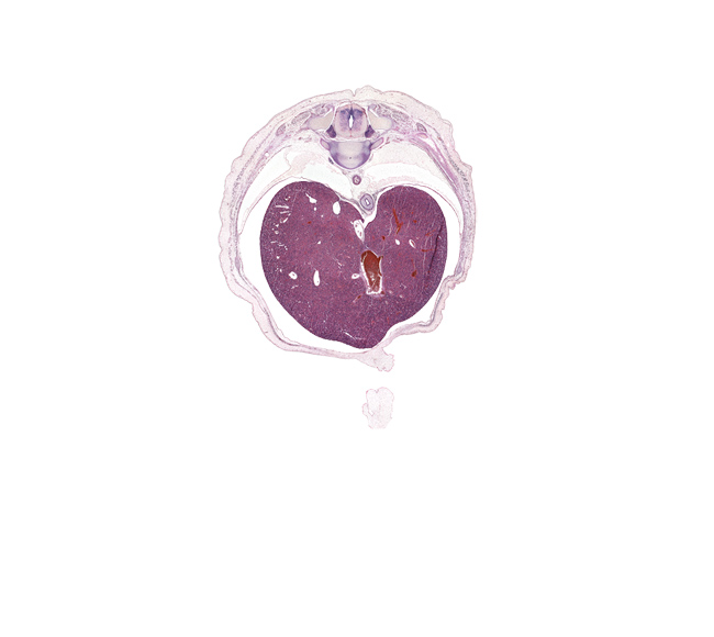 T-9 / T-10 intervertebral disc, T-9 spinal ganglion, aorta, dorsal funiculus, ductus venosus, esophagus muscularis, external abdominal oblique aponeurosis, external abdominal oblique muscle, head of rib 10, inferior vena cava, lateral funiculus, latissimus dorsi muscle, left lobe of liver, liver prominence, peritoneal cavity, rectus abdominis muscle, rib 10, right lobe of liver, umbilical cord, ventral funiculus