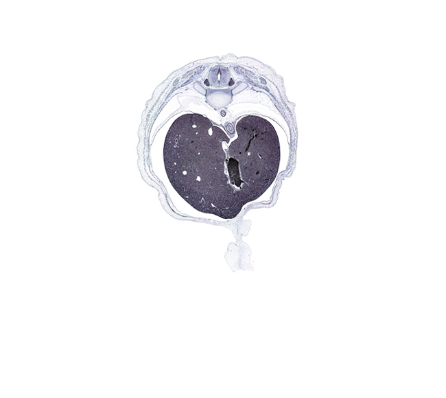 T-9 spinal ganglion, afferent hepatic vein, amnion on surface of umbilical cord, anterior gastric nerve (CN X), caudate lobe of liver, ductus venosus, esophageal hiatus in diaphragm, inferior vena cava, latissimus dorsi muscle, left lobe of liver, muscular part of diaphragm, posterior gastric nerve (CN X), rib 10, right lobe of liver, surface ectoderm, sympathetic trunk, thoracolumbar fascia, tubercle of rib 9, umbilical cord