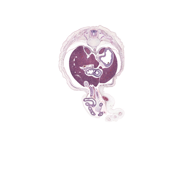 T-10 / T-11 interganglion region, allantois, aorta, artifact separation(s), cystic duct, distal limb of herniated midgut, duodenum (first part), fundus of stomach, gall bladder, hepatic portal vein, inferior vena cava, left lobe of liver, left umbilical artery, lesser curvature of stomach, lesser splanchnic nerve, proximal limb of herniated midgut, pylorus of stomach, quadrate lobe of liver, rib 11, right lobe of liver, right umbilical artery, superior mesenteric artery, superior mesenteric vein, suprarenal gland cortex, umbilical vein