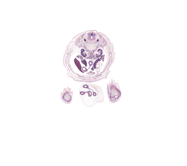 L-1 spinal ganglion, articularis genu muscle, artifact(s), hilum of kidney (metanephros), hindgut, inferior mesenteric artery, inferior vena cava, knee joint, medial condyle of femur, medial condyle of tibia, mesentery, patella, patellar ligament, peritoneal cavity, proximal limb of herniated midgut, quadratus lumborum muscle, quadriceps femoris tendon, right lobe of liver, sympathetic trunk, testis, umbilical coelom, umbilical cord, ureter, vastus medialis muscle