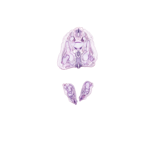 L-5 / S-1 intervertebral disc, L-5 spinal ganglion, S-1 / S-2 intervertebral region, S-1 ventral primary ramus, ala of sacrum, calcaneum, caudal edge of peritoneal cavity, central canal, cuboid, cuneiform 3, fibula, fibularis longus and fibularis brevis muscles, flexor digitorum brevis muscle, gluteus medius muscle, gluteus minimus muscle, iliac crest, ischiorectal fossa, junction of urethra and urethral groove, metatarsal 3 base, neural arch, obturator internus muscle, plantar interosseus muscle, quadratus plantae muscle, rectum endoderm, sacral plexus, sciatic nerve, superior gluteal artery, superior gluteal nerve, talus, urethral fold, urethral groove