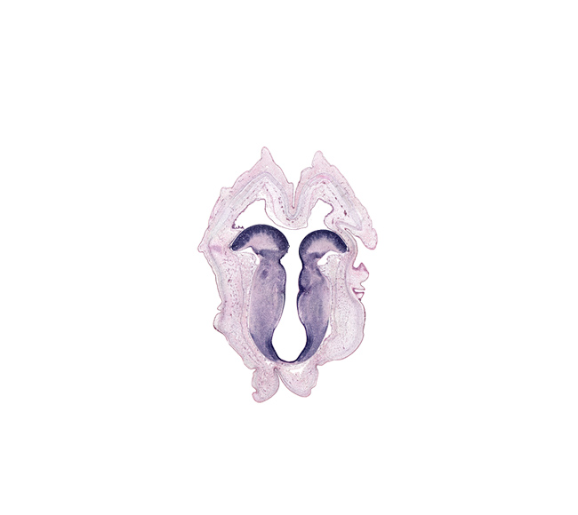 alar plate(s), basal plate, cerebral aqueduct (mesocoele), oculomotor nerve tract, oculomotor nucleus, rhombencoel (fourth ventricle), sulcus limitans, trochlear nucleus, vascular plexus, vestibular area