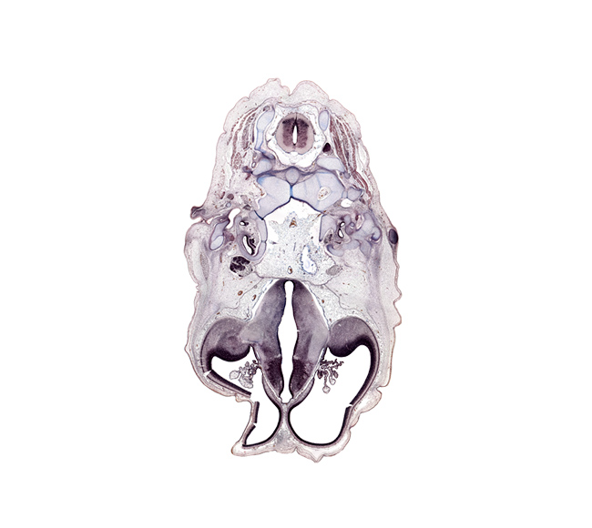 C-2 spinal ganglion, artifact(s), auricle, choroid plexus, cochlear duct, cortical plate, dens of C-2 vertebra (axis), dura mater, facial nerve (CN VII), hippocampus, hypoglossal nerve (CN XII), internal capsule, internal jugular vein, lateral ventricle, lateral ventricular eminence (telencephalon), neural arch of C-2 vertebra (axis), pyriform cortex, stapedius muscle, subarachnoid space, third ventricle, transverse ligament, vertebral artery