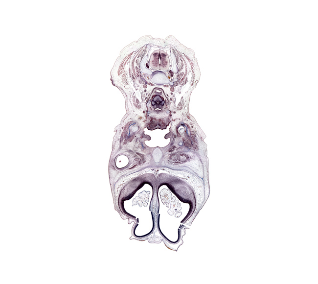 C-5 spinal ganglion, artifact(s), caudal part of laryngeal pharynx, central canal, cortical plate, digastric tendon, ethmoid, glossopharyngeal nerve (CN IX), jugular lymph sac, lacrimal gland buds, mandible, masseter muscle, medial pterygoid muscle, palatine shelf, parotid gland, platysma muscle, surface ectoderm, sympathetic trunk, transverse foramen