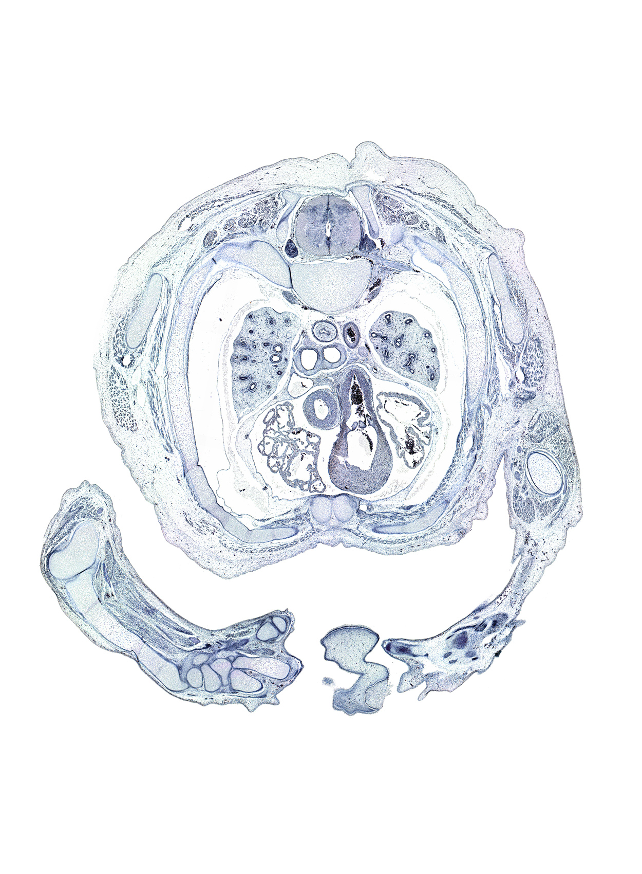 T-3 intercostal nerve, T-3 spinal ganglion, artifact(s), capitate, central canal, costovertebral joint, dorsum of forearm, dura mater, hamate, infundibulum of right ventricle, left vagus nerve (CN X), metacarpal 3, naris, pericardial sac, phrenic nerve, pulmonary semilunar valve, rib 3, rib tubercle, styloid process, sympathetic trunk, tip of nose, triquetrum, trochlea of humerus, ulna