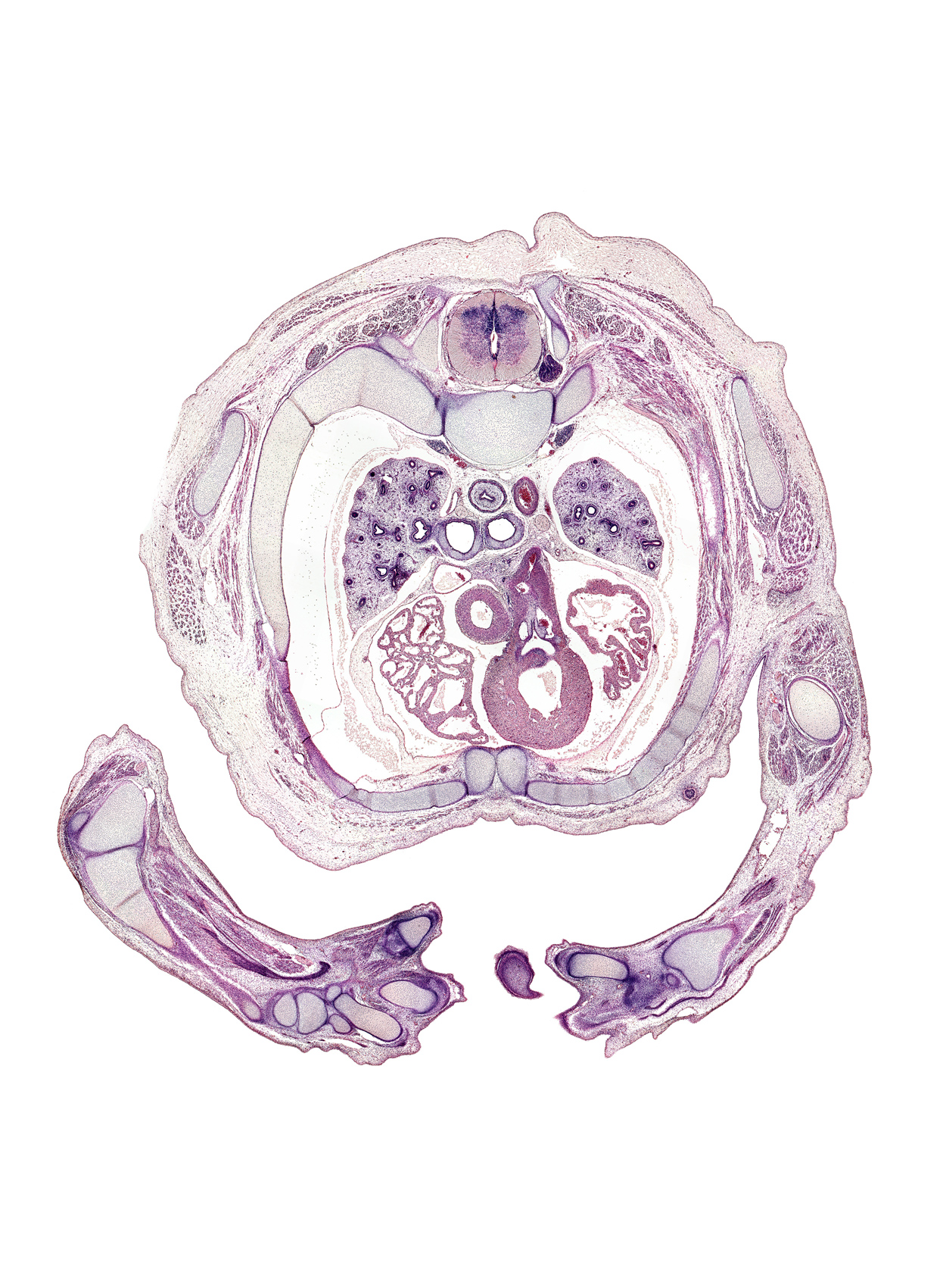 T-3 intercostal nerve, T-3 spinal ganglion, aorta, ascending aorta, brachialis tendon, capitate, carina, caudal edge of nose, central canal, digit 1 (thumb), digit 2 (index finger), digit 3 (middle finger), distal end of ulna, dorsal horn of grey matter, esophagus muscularis, hamate, head of rib 4, hemisternum, lateral horn of grey matter, left atrium, left primary bronchus, mammary gland, metacarpal 3, metacarpal 4, pericardial cavity, radius, rib 4, right primary bronchus, right vagus nerve (CN X), scapula, sympathetic trunk, triquetrum, ulna, ulnar nerve, ventral horn of grey matter