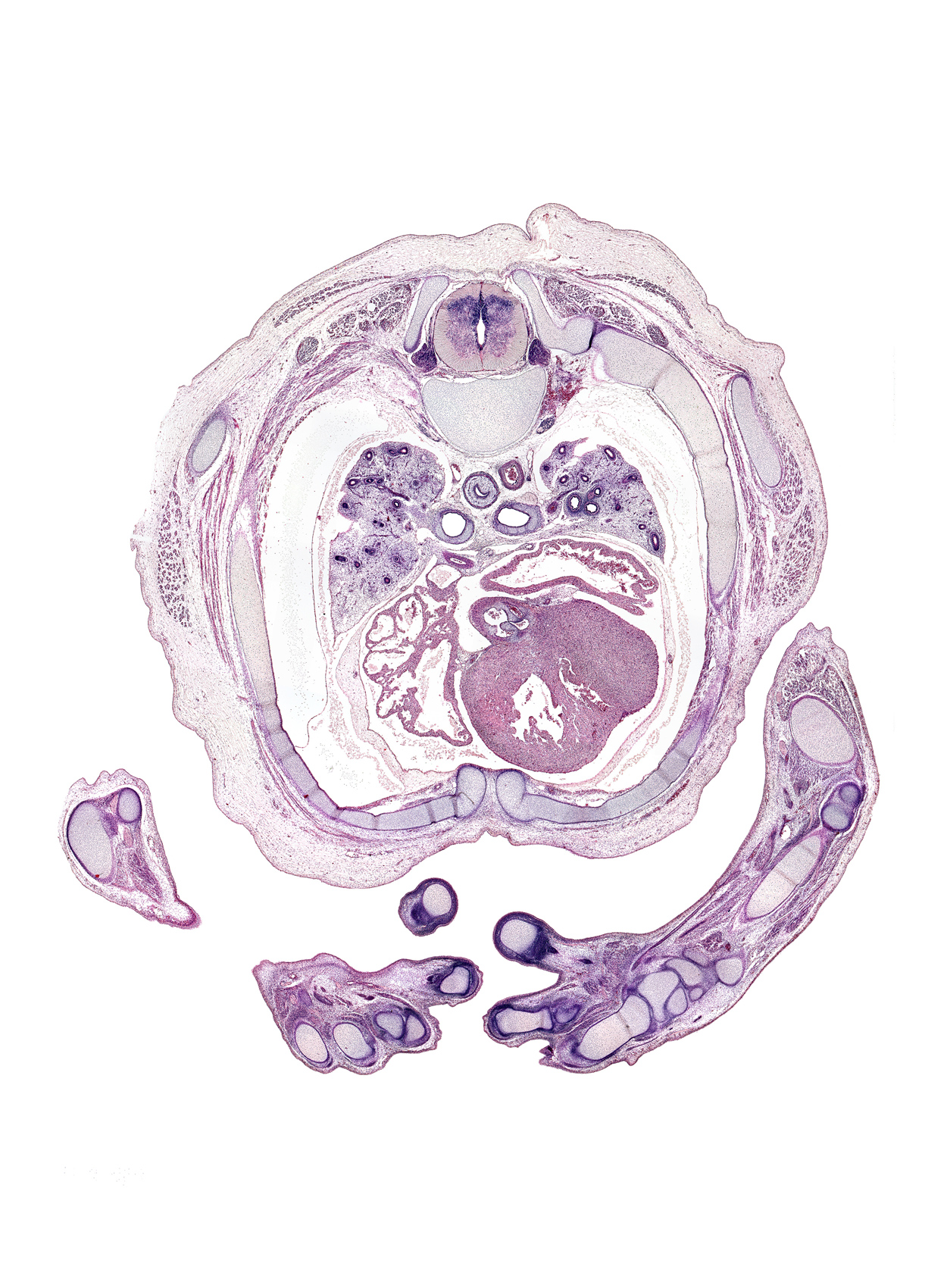 T-4 spinal ganglion, aortic semilunar valve, azygos vein, dorsum of hand, extrapleural loose mesenchyme, flexor digitorum profundus tendon, flexor digitorum superficialis tendon, humerus, interventricular sulcus, left atrium, left primary bronchus, left ventricle, lower lobe of left lung, oblique fissure, pleural cavity, pulmogenic mesenchyme, rib 4, rib 5, right atrium, right primary bronchus, superior vena cava, trabecular part of right ventricle, transverse sinus, triceps brachii muscle, ulnar nerve, upper lobe of left lung