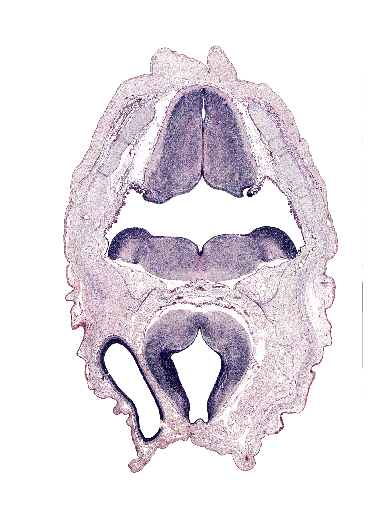 artifact space(s), basilar artery, cephalic edge of endolymphatic sac, cerebral vesicle (hemisphere), dural band for tentorium cerebelli, hypoglossal nucleus, intermediate zone, marginal zone, middle dural venous plexus, myelencephalon (medulla oblongata), osteogenic layer, rhombencoel (fourth ventricle), sulcus limitans, tegmentum of pons, tract of vestibulocochlear nerve (CN VIII), ventricular zone