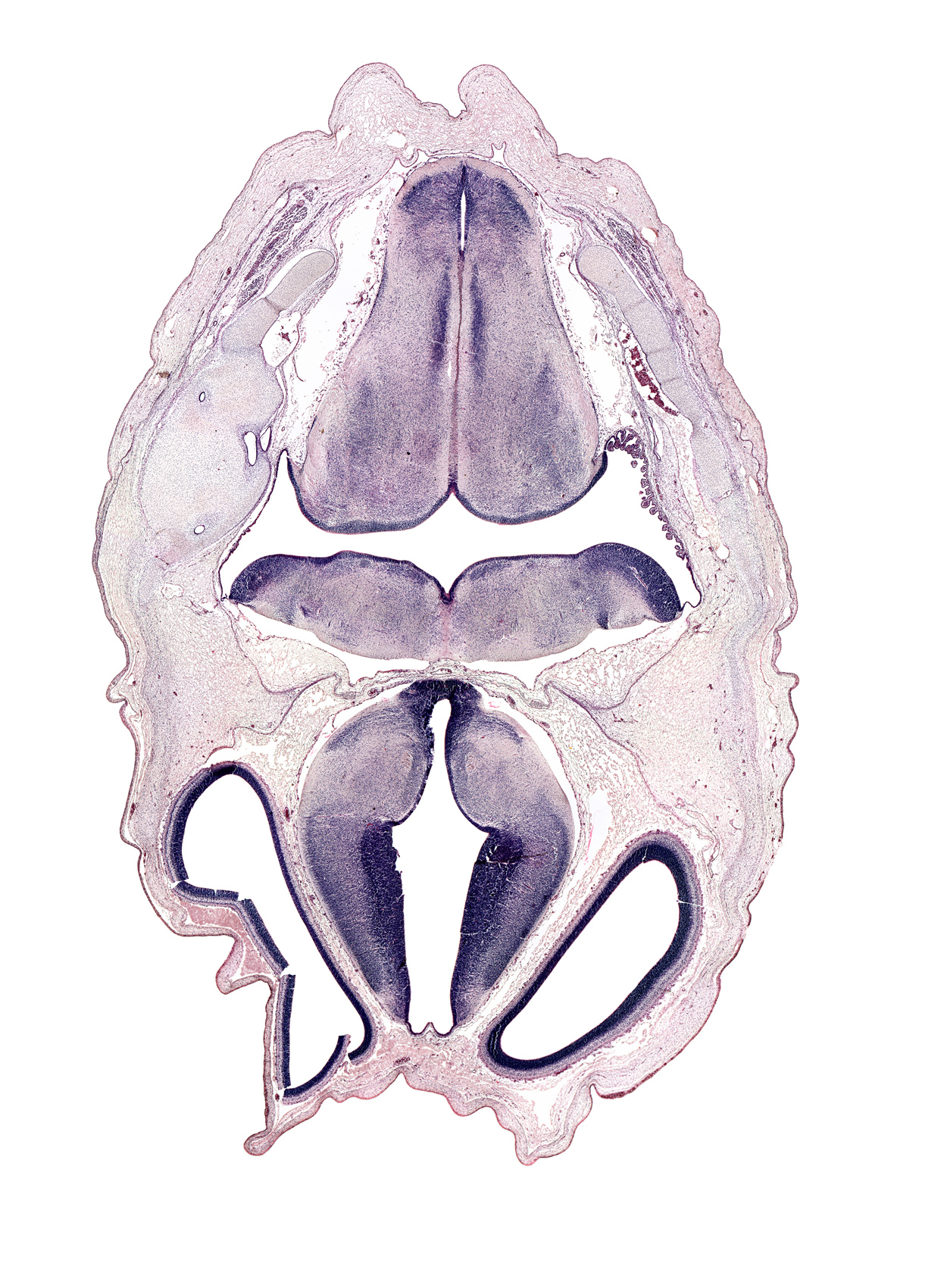 abducens nucleus, artifact fracture(s), basilar artery, central canal, cerebral vesicle (hemisphere), choroid plexus, dural band for tentorium cerebelli, endolymphatic sac, hypothalamic sulcus, hypothalamus, lateral ventricle, medial accessory olivary nucleus, medulla oblongata, rhombencoel (fourth ventricle), roof plate of diencephalon, third ventricle