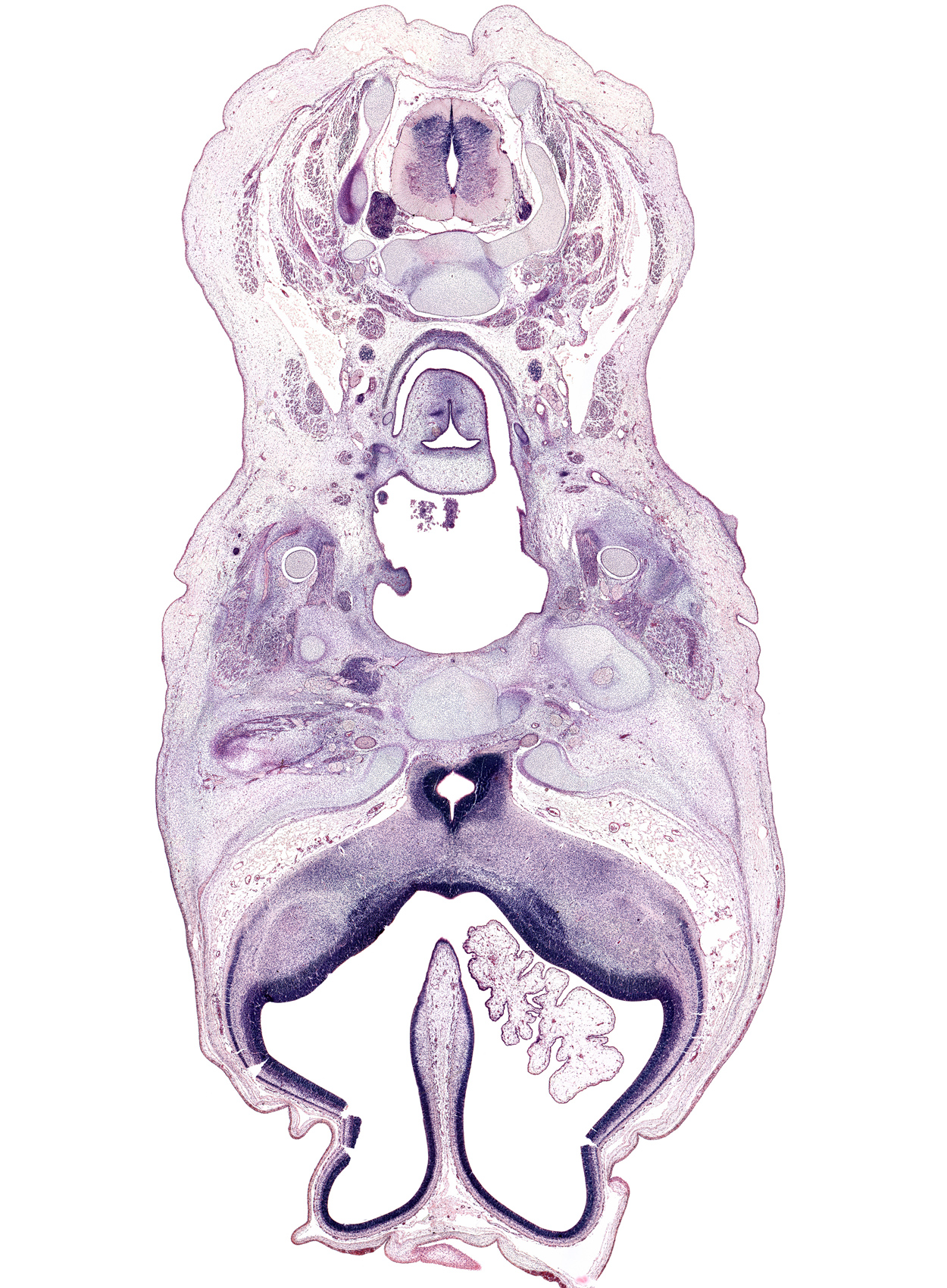 C-3 / C-4 intervertebral disc, C-4 spinal nerve, C-5 spinal ganglion, artifact fracture(s), arytenoid swelling, body of sphenoid, central canal, cerebral vesicle (hemisphere), edge of tongue, glossopharyngeal nerve (CN IX), grey matter, hippocampus, interventricular foramen, jugular lymph sac, lamina terminalis, laryngeal pharynx, masseter muscle, maxillary nerve (CN V₂), medial pterygoid muscle, neopallial cortex, neural arch of C-4 vertebra, optic nerve (CN II), orbitosphenoid, pyriform cortex, sternocleidomastoid muscle, superior cervical sympathetic ganglion, third ventricle, trapezius muscle, vagus nerve (CN X), ventricle of larynx, white matter