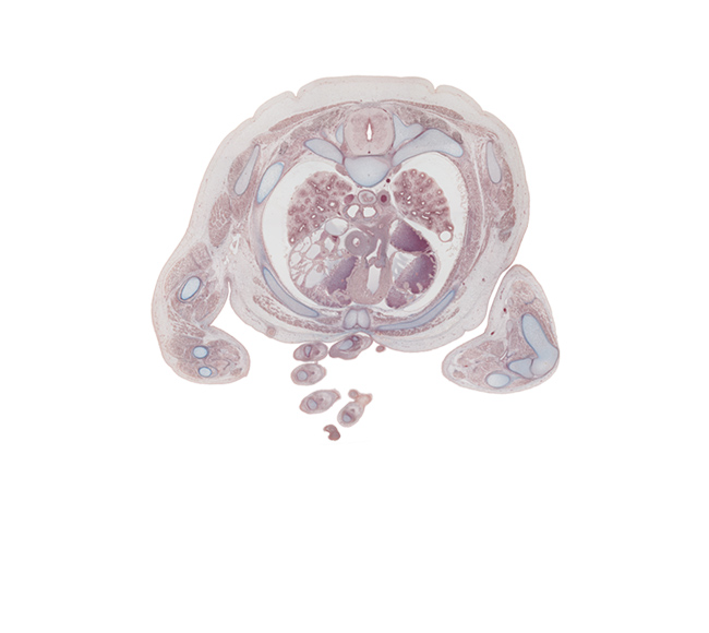 T-3 / T-4 interganglion region, aorta, capitulum of humerus, central canal of spinal cord, dorsal median septum, forearm extensor muscles, forearm flexor muscles, head of radius, hemisternum, humeroradial joint, humerus, intermediate phalynx of digit 4 (ring finger), left atrium, left pulmonary artery, pulmonary semilunar valve, pulmonary trunk, rib 3 (costal cartilage), rib 4, right atrium, right pulmonary artery, right ventricle, sinus venarum, superior vena cava, sympathetic trunk, triceps brachii muscle, ulna, ulnar nerve, upper lobe of left lung, upper lobe of right lung, ventral median septum