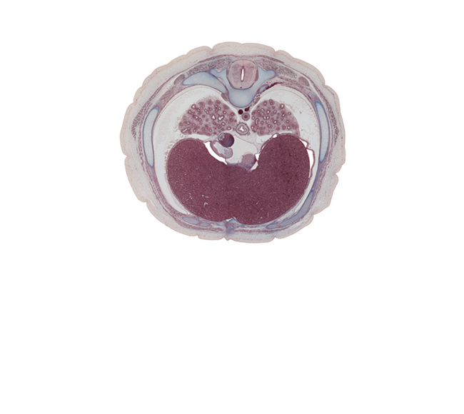 T-7 spinal ganglion, anterior spinal artery, aorta, azygos vein, caudal edge of left ventricle, caudal part of right atrium, costal margin, costodiaphragmatic recess, esophagus, inferior hemi-azygos vein, inferior vena cava, lower lobe of left lung, lower lobe of right lung, pericardial cavity, peritoneal cavity, pleural cavity, posterior spinal artery, rectus abdominis muscle, rib 7, right vagus nerve (CN X), transverse process of T-7 vertebra, xiphoid