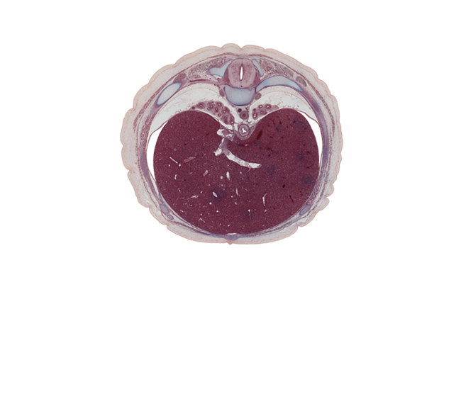 T-8 spinal ganglion, anterior spinal artery, azygos vein, common hepatic vein, costal margin, dorsal horn of grey matter, dorsal meso-esophagus, inferior vena cava, junction of ductus venosus and inferior vena cava, lateral horn of grey matter, left hepatic vein, left lobe of liver, linea alba, lower lobe of left lung, lower lobe of right lung, pulmonary ligament, rectus abdominis muscle, rib 9, right hepatic vein, serratus anterior muscle, sympathetic trunk, ventral horn of grey matter