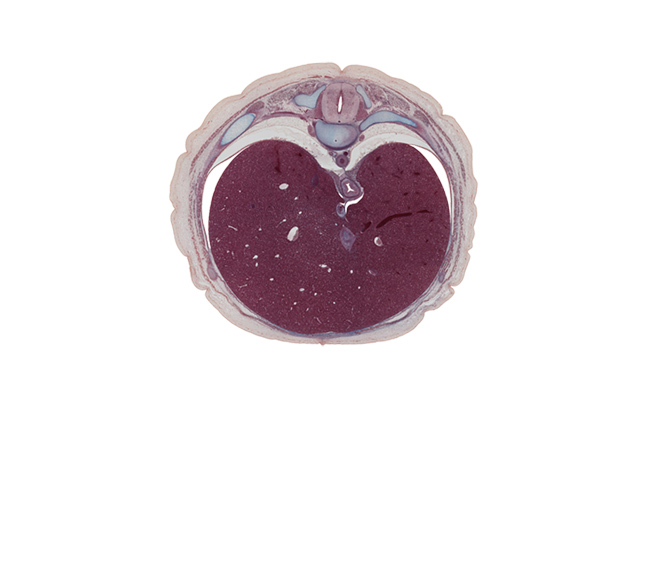 T-9 spinal ganglion, aorta, aponeurosis of external abdominal oblique muscle, caudal part of serratus anterior muscle, dorsal primary ramus, ductus venosus, efferent hepatic vein, esophagus, inferior vena cava, latissimus dorsi muscle, left lobe of liver, normal spina bifida occulta, notochord, rib 10, right lobe of liver, sympathetic trunk, trapezius muscle