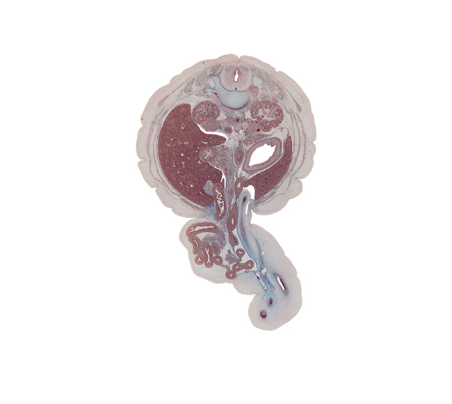 L-1 spinal ganglion, allantoic vesicle(s), anterior wall of stomach, aorta, ascending part of duodenum, colon, descending part of duodenum, edge of urachus, extension of umbilical coelom, gall bladder, head of ventral pancreas, herniated intestines, hilum of kidney (metanephros), inferior vena cava, jejunum, kidney (metanephros), left umbilical artery, lesser sac (omental bursa), mesocolon, right umbilical artery, superior mesenteric artery, superior pancreaticoduodenal artery, suprarenal gland cortex, suprarenal gland medulla, umbilical cord, umbilical vein, umbilical vesicle stalk