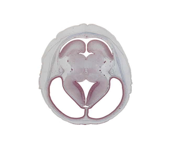 basis pedunculi of pons region (metencephalon), cerebral hemisphere, dorsal thalamus, dural venous sinus, hypothalamic sulcus, internal fiber layer (cerebellum), interpeduncular fossa, lateral ventricle, median sulcus, membrane area of roof of rhombencoel (fourth ventricle), mesencephalic artery, osteogenic layer, rhombencoel (fourth ventricle), subarachnoid space, superior cerebellar artery, superior sagittal sinus, trochlear nerve (CN IV), ventral thalamus