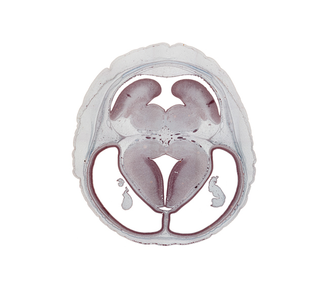 basis pedunculi of pons region (metencephalon), choroid plexus, dorsal thalamus, dural band for tentorium cerebelli, external germinal area, hypothalamic sulcus, intraventricular cerebellum, loose connective tissue space, mesencephalic artery, pons region (metencephalon), rhombencoel (fourth ventricle), subarachnoid space, subcutaneous vascular plexus, superior cerebellar artery, surface ectoderm, trochlear nerve (CN IV), ventral thalamus