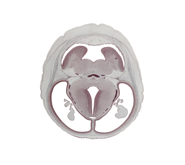 choroid plexus, cortical plate, diverticulum, hypothalamic sulcus, lateral ventricle, membrane area of roof, oculomotor nerve (CN III), pons region (metencephalon), posterior cerebral artery, pyramidal tract region, rhombencoel (fourth ventricle), superior cerebellar artery, third ventricle, trochlear nerve (CN IV)