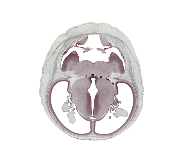 basilar artery, choroid plexus, dorsal thalamus, dural band for tentorium cerebelli, dural limiting layer, hypothalamic sulcus, hypothalamus, medulla oblongata, oculomotor nerve (CN III), posterior communicating artery, subarachnoid space, trochlear nerve (CN IV), ventral thalamus, vestibular nucleus region