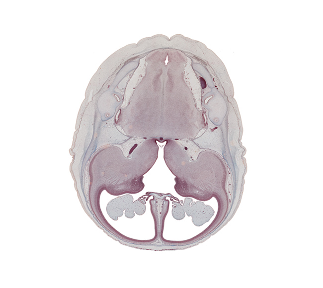 anterior semicircular duct, central canal, choroid fissure, choroid plexus, common limb of semicircular duct, cortical plate, decussation, edge of lateral recess of rhombencoel (fourth ventricle), endolymphatic duct, exoccipital, falx cerebri region, internal capsule, interventricular foramen, lateral ventricular eminence (telencephalon), medial accessory olivary nucleus, medial ventricular eminence (diencephalon), oculomotor nerve (CN III), pons region (metencephalon), pyramidal tract region, root of cranial accessory nerve (CN XI), root of vagus nerve (CN X), third ventricle, trochlear nerve (CN IV)