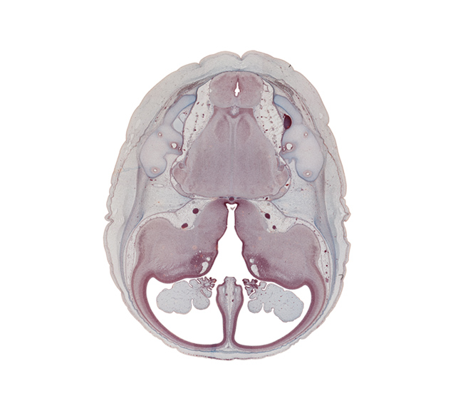 anterior inferior cerebellar artery, anterior semicircular duct, basilar artery, common limb of semicircular duct, cortical plate, decussation, endolymphatic duct, falx cerebri region, insula of cerebral hemisphere, internal carotid artery, lateral ventricle, lateral ventricular eminence (telencephalon), medial ventricular eminence (diencephalon), nucleus cuneatus, nucleus gracilis, nucleus of spinal tract of trigeminal nerve, oculomotor nerve (CN III), optic tract, pons region (metencephalon), posterior inferior cerebellar artery, posterior semicircular duct, pyramidal tract region, root of cranial accessory nerve (CN XI), root of glossopharyngeal nerve (CN IX), root of vagus nerve (CN X), subarachnoid space, third ventricle, trochlear nerve (CN IV)