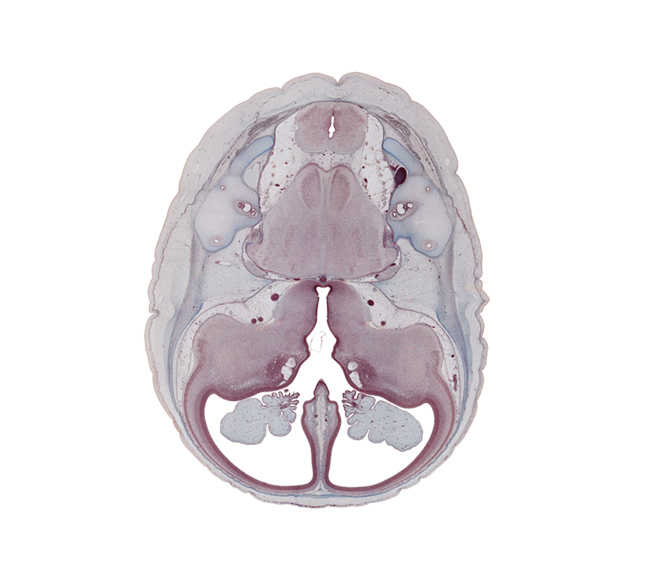 anterior semicircular duct, choroid plexus, common limb of semicircular duct, dural band for tentorium cerebelli, fasciculus cuneatus, fasciculus gracilis, hippocampus, interventricular foramen, lateral ventricle, medial accessory olivary nucleus, optic groove, origin of facial nerve (CN VII), origin of hypoglossal nerve (CN XII), origin of vestibulocochlear nerve (CN VIII), pons region (metencephalon), posterior semicircular duct, pyramidal tract region, region of cervical flexure, root of trigeminal nerve (CN V), sigmoid sinus, spinal tract of trigeminal nerve (CN V), third ventricle