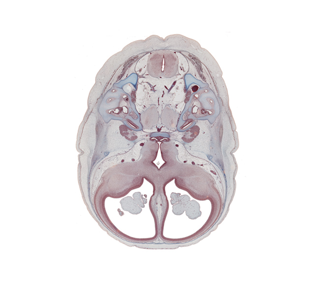 accessory nerve (CN XI), basilar artery, central canal, choroid plexus, cochlear duct, dorsum sellae, edge of pons region (metencephalon), frontal bone ossification, glossopharyngeal nerve (CN IX), hypothalamus, internal carotid artery, jugular foramen, lateral semicircular duct, lateral ventricle, lateral ventricular eminence (telencephalon), lesser wing of sphenoid, medial ventricular eminence (diencephalon), neurohypophysis, origin of abducens nerve (CN VI), posterior semicircular duct, prosencephalic septum, saccule(s), sulcus terminalis, trigeminal ganglion (CN V), vagus nerve (CN X), vestibulocochlear nerve (CN VIII)