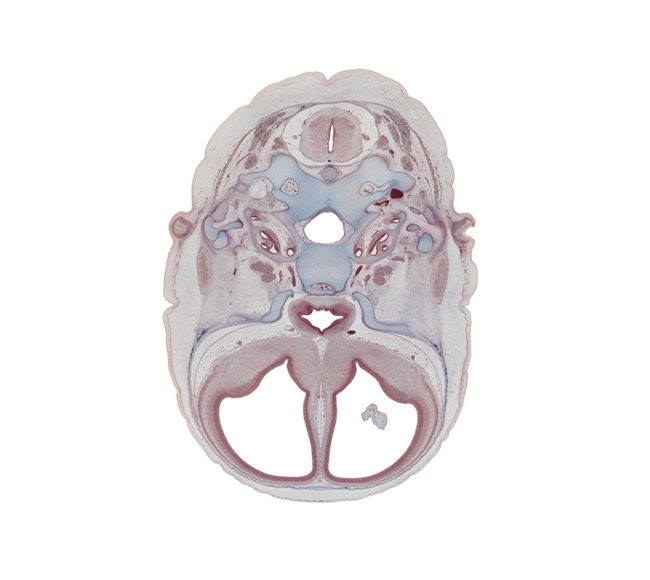 C-1 spinal ganglion, anterior spinal artery, basi-occipital (basal plate), central canal, cochlear duct, cranial cavity, edge of choroid plexus, hypoglossal canal, hypophysial fossa, incus, intermediate zone, internal carotid artery, internal jugular vein, lamina terminalis, lesser wing of sphenoid, malleus, mandibular nerve (CN V₃), marginal zone, nucleus accumbens, ophthalmic nerve (CN V₁), optic chiasma (chiasmatic plate), optic groove, piriform cortex (paleopallium), styloid process, temporalis muscle, tuberculum sellae, ventricular zone