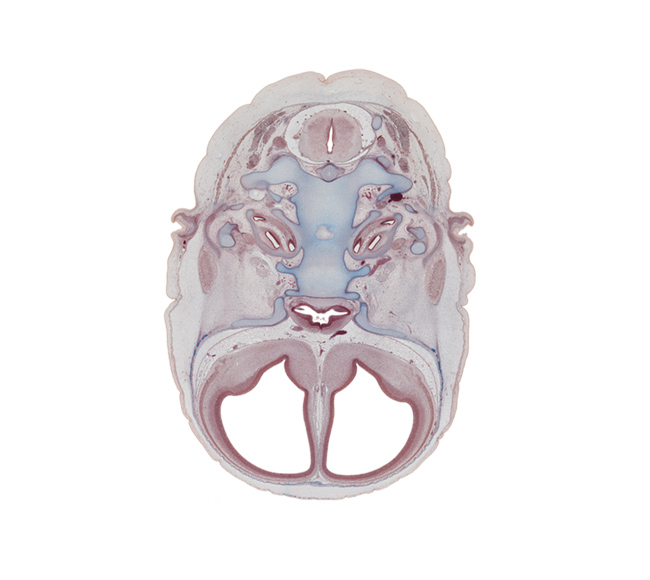 C-1 spinal ganglion, basi-occipital (basal plate), basisphenoid, edge of cranial cavity, facial nerve (CN VII), greater wing of sphenoid, hippocampus, hypoglossal canal, incus, internal carotid artery, lateral ventricle, lateral ventricular eminence (telencephalon), lesser wing of sphenoid, malleus, mandibular nerve (CN V₃), maxillary nerve (CN V₂), neural arch of C-1 vertebra (atlas), nucleus accumbens, occipital condyle, ophthalmic nerve (CN V₁), optic canal, optic chiasma (chiasmatic plate), optic groove, pre-optic area, vertebral artery