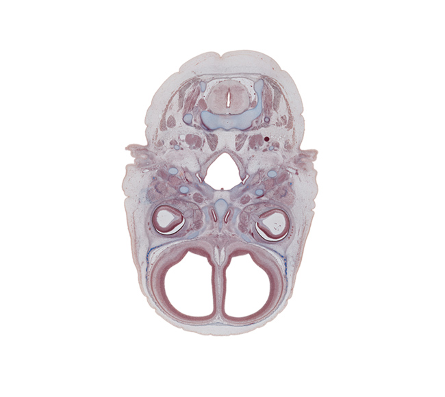 C-2 spinal ganglion, centrum of C-2 vertebra (axis), cortical plate, ethmoid, internal jugular vein, intervertebral foramen, intraretinal space (optic vesicle cavity), lacrimal gland buds, lateral ventricular eminence (telencephalon), medial pterygoid muscle, nasopharynx, neural layer of retina, opening of pharyngotympanic tube, optic nerve (CN II), pharyngeal arch 1 cartilage (Meckel), pigmented layer of retina, posterior belly of digastric and stylohyoid muscles, pterygopalatine ganglion, styloid process, superior pharyngeal constrictor muscle