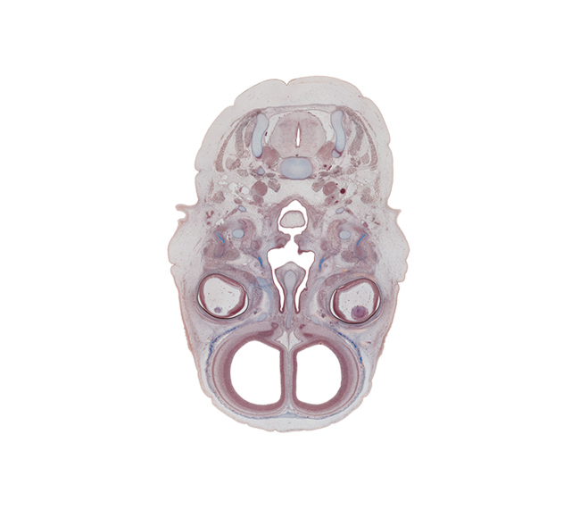 C-3 spinal ganglion, choana, cortical plate, falx cerebri region, frontal bone ossification, frontal lobe region of cerebral hemisphere, inferior ganglion of vagus nerve (CN X), intraretinal space (optic vesicle cavity), laryngeal pharynx, longissimus capitis muscle, medial pterygoid muscle, nasal cavity (nasal sac), nasal septal cartilage, nasopharynx, neural layer of retina, oropharynx, pigmented layer of retina, retropharyngeal space, semispinalis capitis muscle, splenius muscle, superior pharyngeal constrictor muscle, superior sagittal sinus, trapezius muscle, unfused palatine shelf