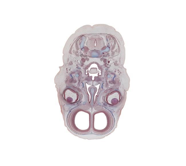 C-3 spinal ganglion, cornea, cortical plate, epiglottis, external carotid artery, fusion region of palatine shelves, lens, nasal cavity (nasal sac), nasal septum, obicularis oculi muscle, olfactory bulb, olfactory epithelium (placode), olfactory filia (CN I), parotid gland (secondary branches), pharyngeal arch 1 cartilage (Meckel), semispinalis capitis muscle, splenius muscle, sternocleidomastoid muscle, subarachnoid space, superior cervical sympathetic ganglion, superior nasal meatus