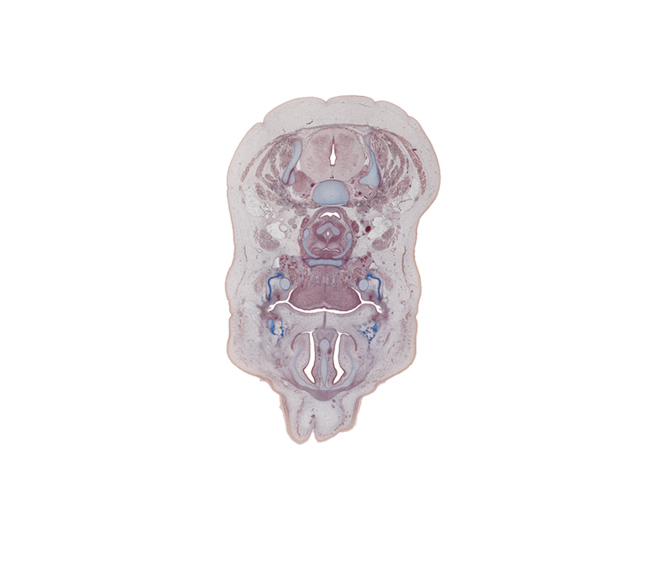 C-5 / C-6 interganglion region, C-5 spinal nerve, body of hyoid (pharyngeal arch 3 cartilage), common carotid artery, fusion region of palatine shelves, inferior nasal concha, internal jugular vein, linguogingival sulcus, mandible ossification, maxilla ossification, nasolacrimal duct, semispinalis cervicis muscle, splenius muscle, sternocleidomastoid muscle, submandibular duct, submandibular gland, superior parathyroid gland, trapezius muscle, vagus nerve (CN X), vomeronasal organ