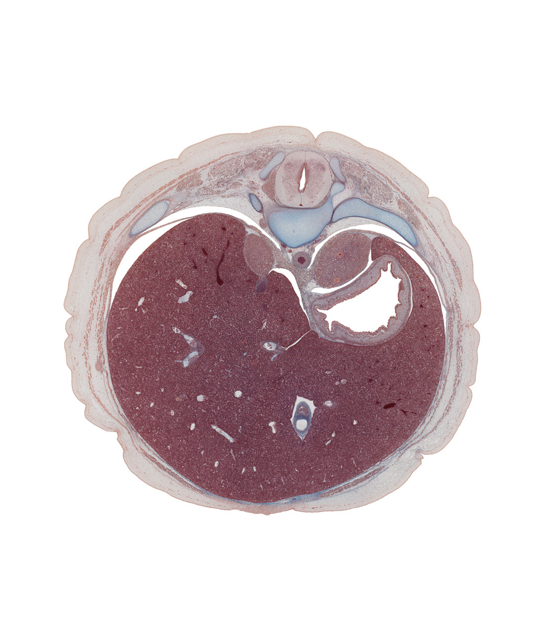 T-10 / T-11 interganglion region, aorta, central canal, diaphragm, dorsal horn of grey matter, dorsal mesogastrium, ductus venosus, gastric fold(s), inferior vena cava, lateral funiculus, lateral horn of grey matter, left lobe of liver, peritoneal cavity, rib 11, right lobe of liver, suprarenal gland, sympathetic trunk, ventral funiculus, ventral horn of grey matter