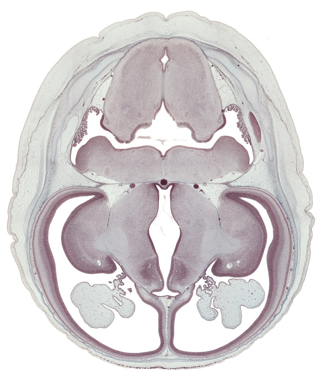 basal plate, basilar artery, central canal, cephalic edge of endolymphatic sac, cerebral arteries in pia mater, choroid plexus, dorsal thalamus, dural band for tentorium cerebelli, fusion region with anterior choroidal artery, hypoglossal nucleus, hypothalamus, internal capsule, median sulcus, medulla oblongata, neopallial cortex, posterior communicating artery, roof of third ventricle, striatothalamic fibers, subthalamus, sulcus dorsalis, sulcus limitans, sulcus medius, transverse sinus, ventral thalamus