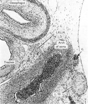 Ganglion on a cardiac nerve