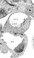 The sinu-atrial node