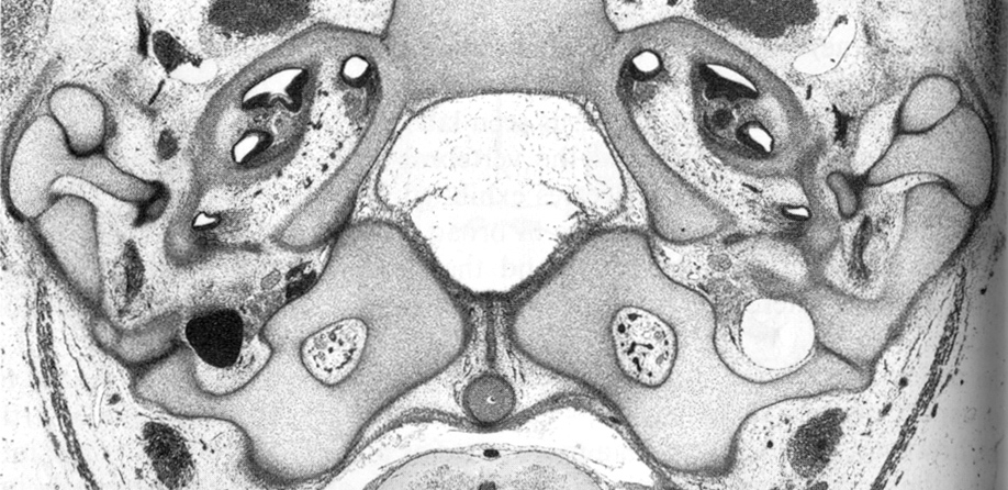 Transverse section through the base of the skull