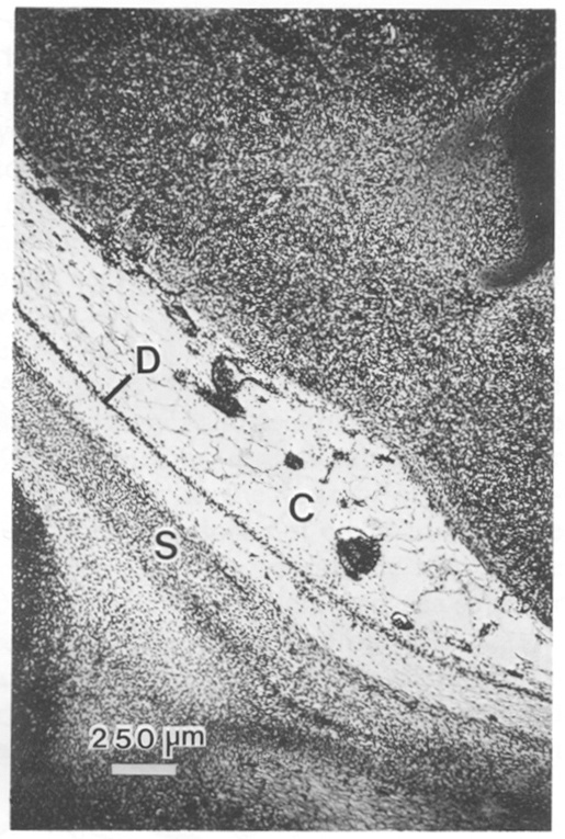 Dura and cisterna